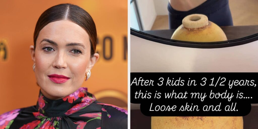 Mandy Moore Shares Honest Post-Baby Body Reality